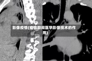影像疫情(疫情期间医学影像技术的作用)