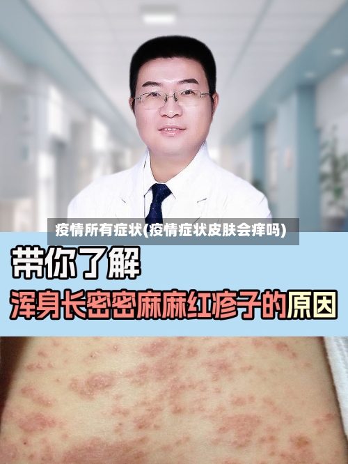 疫情所有症状(疫情症状皮肤会痒吗)-第3张图片