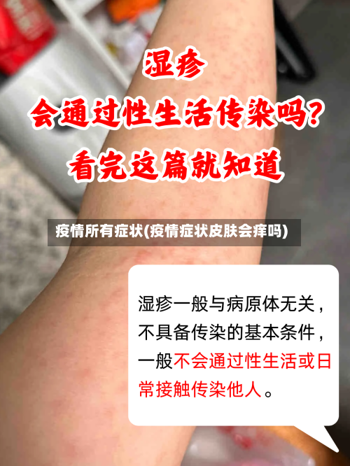 疫情所有症状(疫情症状皮肤会痒吗)-第1张图片